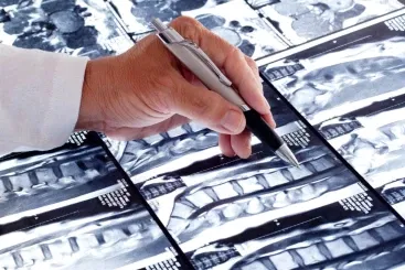 $26.3 Million For Man Who Suffered Brain And Spinal Cord Injury