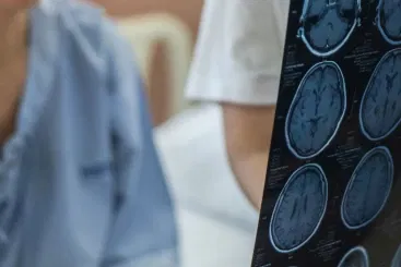 Brain Injury
