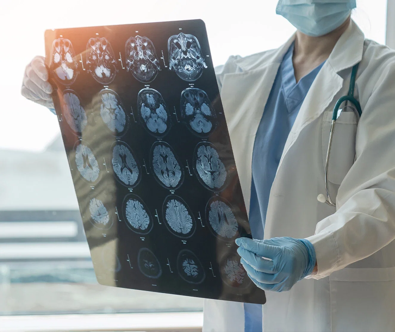 brain-cts.jpg