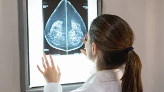 Radiologist reviewing mammogram film on a lightbox for breast cancer misdiagnosis or malpractice lawsuit