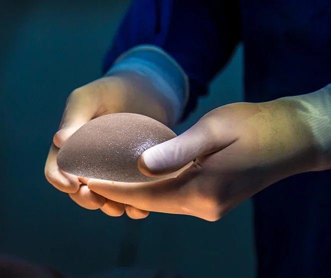 Doctor holding breast implant