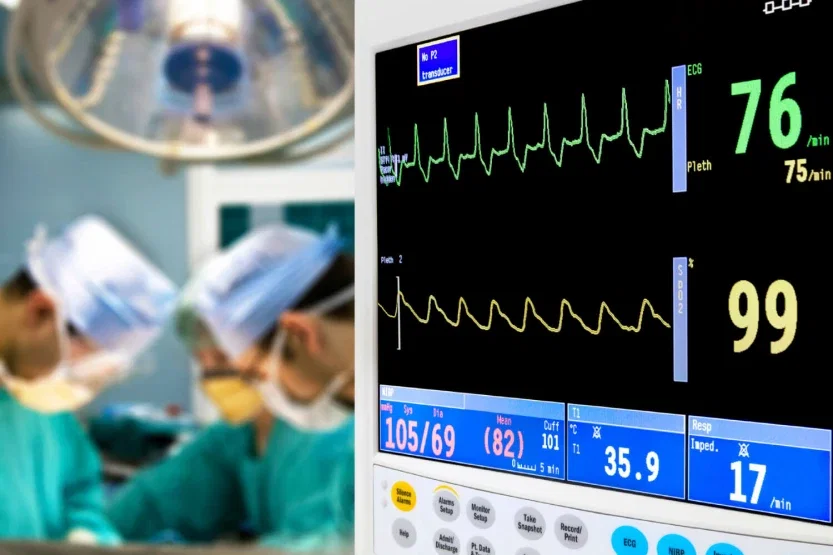 Cardiac monitor displaying vital signs in operating room during surgery related to medical malpractice claim