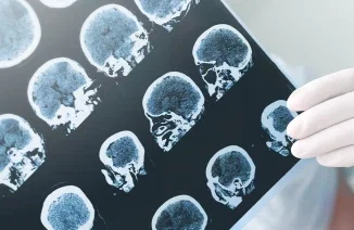 Brain Injury