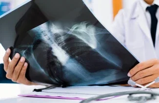 Lung Cancer