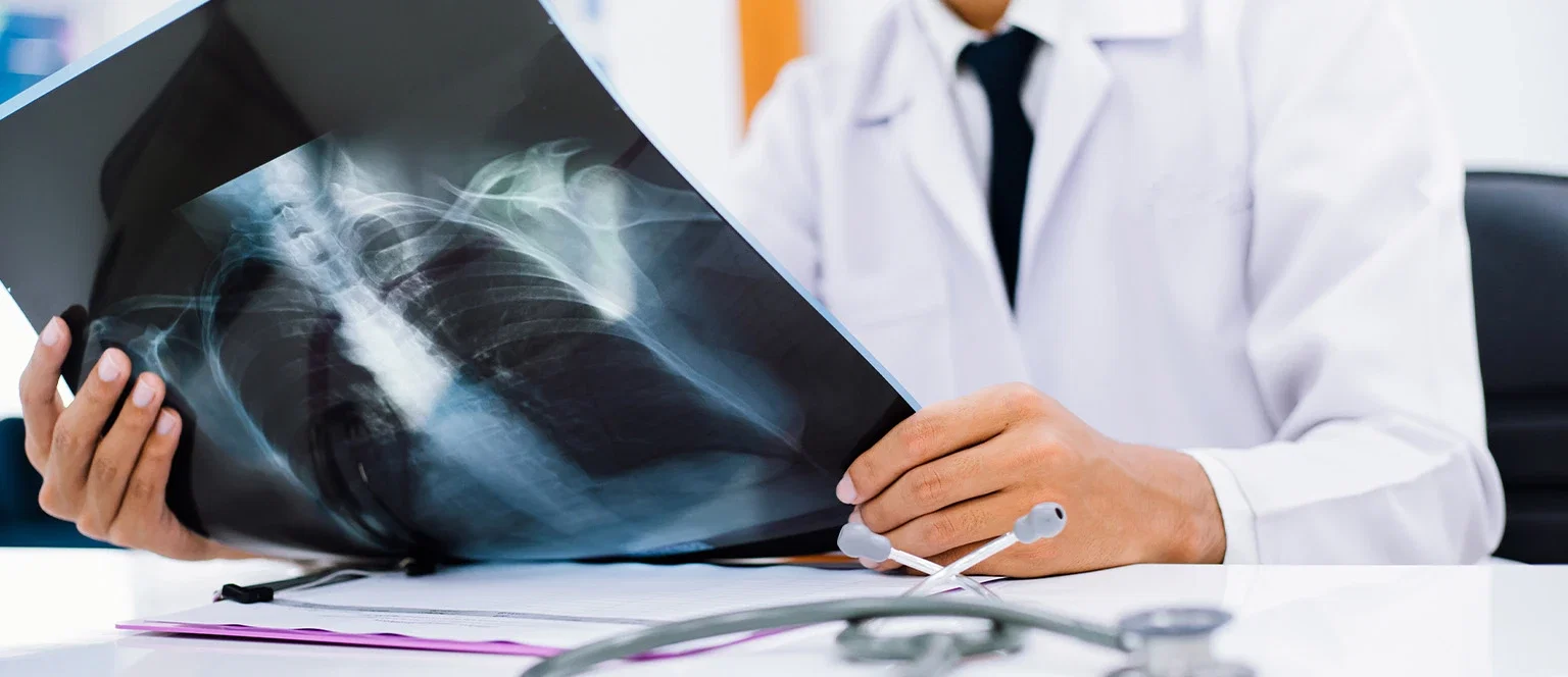 A doctor in a white coat seated at a desk, holding up and examining a chest X-ray film, with a stethoscope and paperwork visible on the desk
