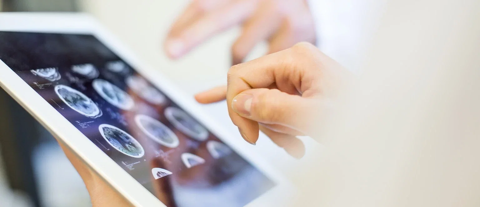 Doctor pointing to brain MRI scans on a tablet for stroke misdiagnosis and medical malpractice litigation