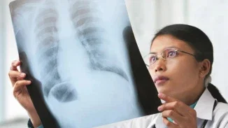 A female doctor wearing glasses and a white coat carefully examining a chest X-ray film held up to the light