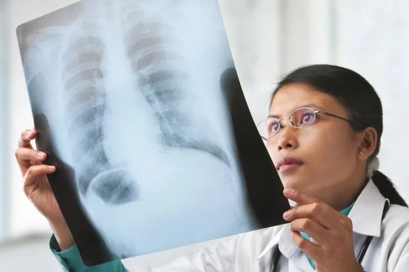 A female doctor wearing glasses and a white coat carefully examining a chest X-ray film held up to the light