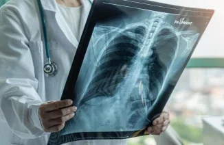 Failure to Diagnose Cancer