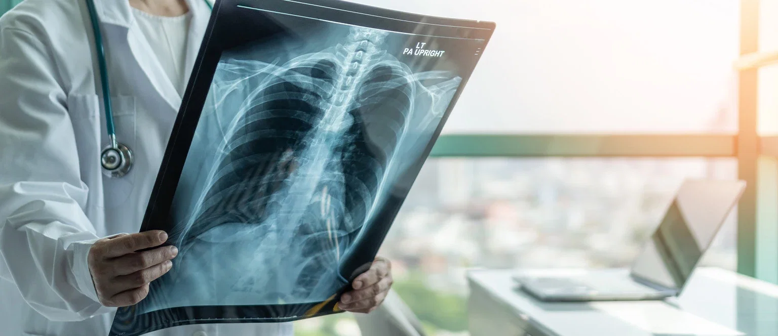A doctor in a white coat and stethoscope holding up a chest X-ray film and examining it near a window